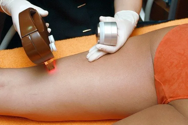 Depilacja laserowa – pozbądź się włosków na stałe!